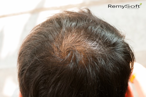 healthier regrow hair formula